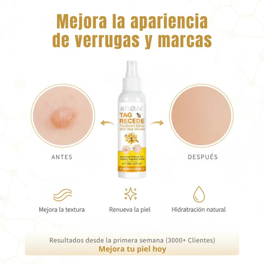 Tag Recede - Spray eliminador de verrugas de veneno de abeja - 60ml